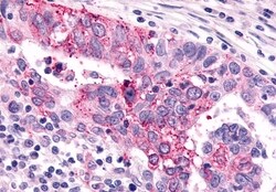 Invitrogen mGluR6 Polyclonal Antibody 50 &mu;g; Unconjugated:Antibodies,