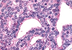 Invitrogen mGluR6 Polyclonal Antibody 50 &mu;g; Unconjugated:Antibodies,