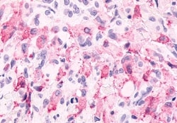 Invitrogen mGluR6 Polyclonal Antibody 50 &mu;g; Unconjugated:Antibodies,