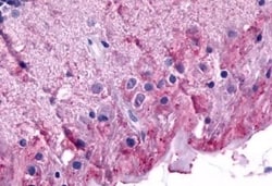 Invitrogen mGluR6 Polyclonal Antibody 50 &mu;g; Unconjugated:Antibodies,