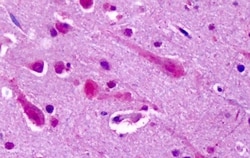 Invitrogen mGluR7 Polyclonal Antibody 50 μg; Unconjugated:Antibodies,