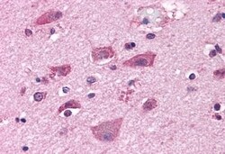 Invitrogen mGluR7 Polyclonal Antibody 50 &mu;g; Unconjugated:Antibodies,