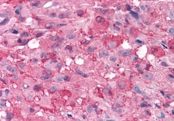 Invitrogen mGluR7 Polyclonal Antibody 50 &mu;g; Unconjugated:Antibodies,