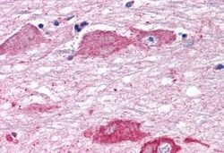 Invitrogen mGluR7 Polyclonal Antibody 50 &mu;g; Unconjugated:Antibodies,