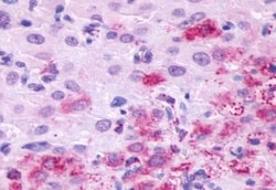 Invitrogen LHR Polyclonal Antibody 50 &mu;g; Unconjugated:Antibodies, Polyclonal
