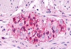Invitrogen LHR Polyclonal Antibody 50 &mu;g; Unconjugated:Antibodies, Polyclonal