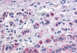 Invitrogen Orexin Receptor 1 Polyclonal Antibody 50 &mu;g; Unconjugated:Antibodies,
