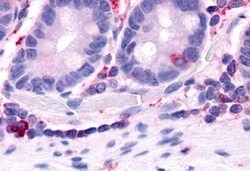 Invitrogen HNF4G Polyclonal Antibody 50 &mu;g | Buy Online | Invitrogen&trade; | Fisher Scientific