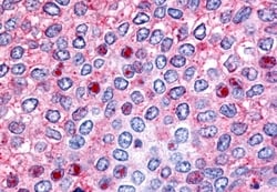 Invitrogen HNF4G Polyclonal Antibody 50 &mu;g | Buy Online | Invitrogen&trade; | Fisher Scientific