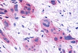 Invitrogen HNF4G Polyclonal Antibody 50 &mu;g | Buy Online | Invitrogen&trade; | Fisher Scientific