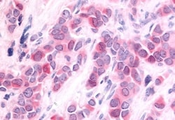 Invitrogen HUNK Polyclonal Antibody 50 &mu;g; Unconjugated:Antibodies,