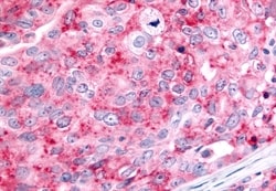 Invitrogen HUNK Polyclonal Antibody 50 &mu;g; Unconjugated:Antibodies,
