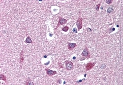 Invitrogen KV1.3 (KCNA3) Polyclonal Antibody 50 &mu;g; Unconjugated:Antibodies,