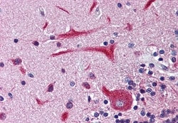 Invitrogen KCNH2 Polyclonal Antibody 50 &mu;g; Unconjugated:Antibodies,