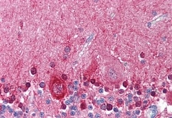 Invitrogen KCNMA1 Polyclonal Antibody 50 &mu;g; Unconjugated:Antibodies,