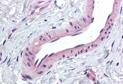 Invitrogen KCNMA1 Polyclonal Antibody 50 &mu;g; Unconjugated:Antibodies,