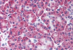 Invitrogen KCNN4 Polyclonal Antibody 50 &mu;g; Unconjugated:Antibodies,