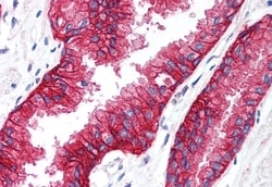 Invitrogen KCNN4 Polyclonal Antibody 50 &mu;g; Unconjugated:Antibodies,