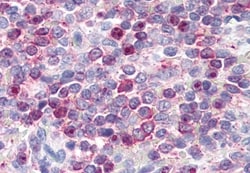 Invitrogen LTB4R Polyclonal Antibody 50 &mu;g; Unconjugated:Antibodies,
