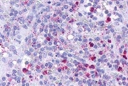 Invitrogen LTB4R Polyclonal Antibody 50 μg; Unconjugated:Antibodies,