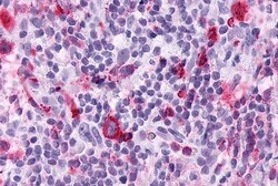 Invitrogen LTB4R Polyclonal Antibody 50 μg; Unconjugated:Antibodies,