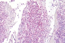 Invitrogen LTB4R Polyclonal Antibody 50 μg; Unconjugated:Antibodies,