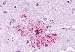 Invitrogen LTB4R Polyclonal Antibody 50 μg; Unconjugated:Antibodies,