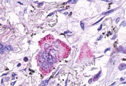 Invitrogen LGR4 Polyclonal Antibody 50 μg; Unconjugated:Antibodies,