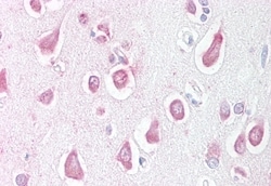 Invitrogen LINGO1 Polyclonal Antibody 50 &mu;g; Unconjugated:Antibodies,