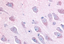 Invitrogen LINGO1 Polyclonal Antibody 50 &mu;g; Unconjugated:Antibodies,