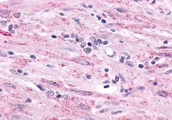 Invitrogen LPHN2 Polyclonal Antibody 50 &mu;g; Unconjugated:Antibodies,