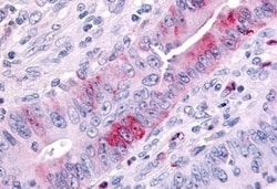 Invitrogen MLK1 Polyclonal Antibody 50 &mu;g; Unconjugated:Antibodies,