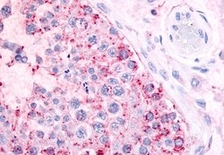 Invitrogen MAS1 Polyclonal Antibody 50 &mu;g; Unconjugated:Antibodies,