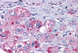 Invitrogen MAS1 Polyclonal Antibody 50 &mu;g | Buy Online | Invitrogen&trade; | Fisher Scientific