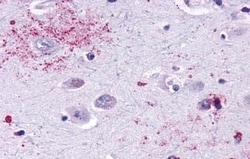 Invitrogen MAS1 Polyclonal Antibody 50 &mu;g | Buy Online | Invitrogen&trade; | Fisher Scientific