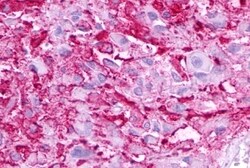 MC5R Polyclonal Antibody 50 &mu;g | Buy Online | Invitrogen | Fisher Scientific