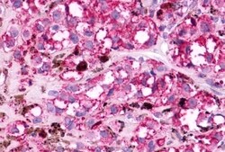 MC5R Polyclonal Antibody 50 &mu;g | Buy Online | Invitrogen | Fisher Scientific