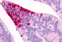 MC5R Polyclonal Antibody 50 &mu;g | Buy Online | Invitrogen | Fisher Scientific