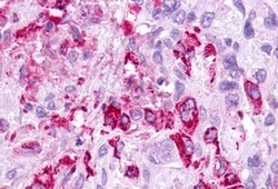 MC5R Polyclonal Antibody 50 &mu;g | Buy Online | Invitrogen | Fisher Scientific