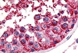 MC5R Polyclonal Antibody 50 &mu;g | Buy Online | Invitrogen | Fisher Scientific