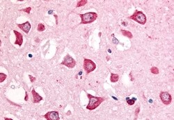 Invitrogen MINK1 Polyclonal Antibody 50 &mu;g; Unconjugated:Antibodies,