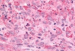 Invitrogen MINK1 Polyclonal Antibody 50 &mu;g; Unconjugated:Antibodies,