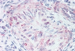 MLNR Polyclonal Antibody:Anticuerpos