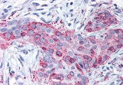 Invitrogen MMP13 Polyclonal Antibody 50 μg; Unconjugated:Antibodies,