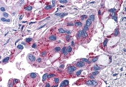 Invitrogen MRGPRX2 Polyclonal Antibody 50 &mu;g; Unconjugated:Anticuerpos