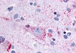 Invitrogen MRGPRX3 Polyclonal Antibody 50 &mu;g | Buy Online | Invitrogen&trade; | Fisher Scientific