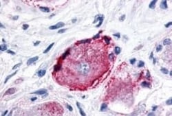 Invitrogen MRGPRX3 Polyclonal Antibody 50 &mu;g | Buy Online | Invitrogen&trade; | Fisher Scientific