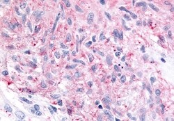 Invitrogen MRGPRX4 Polyclonal Antibody 50 &mu;g; Unconjugated:Antibodies,