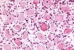 Invitrogen MRGPRX4 Polyclonal Antibody 50 &mu;g; Unconjugated:Antibodies,