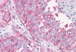 Invitrogen NEK6 Polyclonal Antibody 50 μg; Unconjugated:Antibodies,